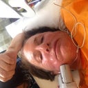 Trainer applying the laser to my cheek. First they coat the area with gel.