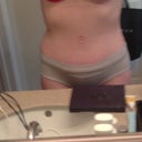 5 1/2 weeks out.  My swelling seems to be getting better, and I really think the compression garment has a lot to do with that. The only true issue I'm having now is with a slight infection or spitting spit at the top of my belly button. I suppose that is relatively minor compared to what I could be dealing with :-)