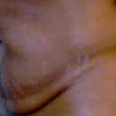 before (yuk) side pic