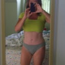 3 month post full TT with muscle tightening
