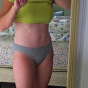 3 month post op