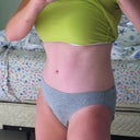 3 months post op