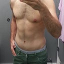 Post Op - 3 months