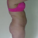 Pre Op
