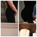 before surgery, and after....taken the same day