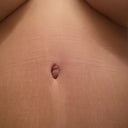 9 Weeks PO - Up close belly button