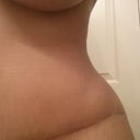 9 Weeks PO Up close contouring by PS
