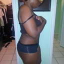 this is about 1 1/2 week post op... as you can see, i am still hunched over