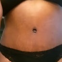 this is about 12 days post op.