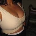 In surgical bra right after surgery... Can already see immediate results!