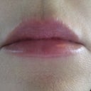 ONE WEEK AFTER