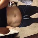 2 days before surgery