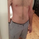 Post Op - 9 weeks