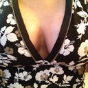 swimsuit three/5 weeks post op - close up