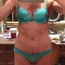 Scar is fading nicely --- so, so happy. Don't mind the massive mess of my bathroom, btw.