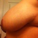 Right boob