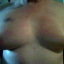 After front.