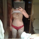 4 days post op