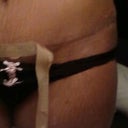 I am really liking my scar , Where is it?