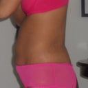 Left side of my belly button is getting touch up tomorrow