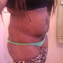 Pre op 4/7/12