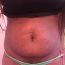Last one...i wonder how much of my stretch marks will still be there...
