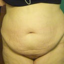 Before front view