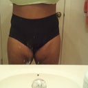 Week 4 post op