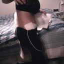2 days post op