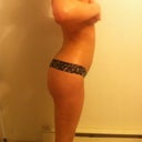 5 weeks post op