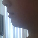 pre-op