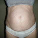 Before: Whoa!