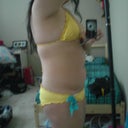 Pre-op right side.