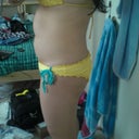 Pre-op left side.
