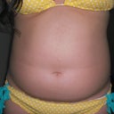 Pre-op belly close up.  Not the crease to differentiate my top and bottom belly.
