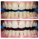 Before and After pictures they emailed me