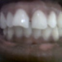 Pre-treatment
