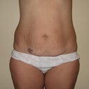 Sure will miss those stretch marks and that lovely tattoo :)
