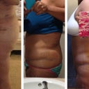 Progression.  Day 2 PO, Day 5 PO, Day 10 PO.