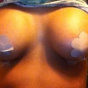 day 5 post-op.  left is still more full, right is in my armpit a bit - very frustrating.