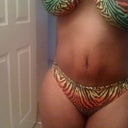 Day 16 post op