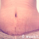 not sure if the scar is uneven from swelling, my body's alignment or the incision itself but i am just happy it is so low!