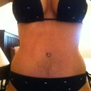 5 weeks post op. Close up of bruising - I really feel like it looks worse in pics than in person