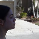 profile 6 week post-op