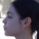 Profile 6 week post-op