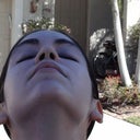 Nostril view 6 week post-op