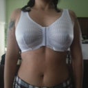 Day 1 Post Op Front w/ bra 375/425cc HP
