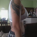 Day 1 Post Op Right w/ bra 375/425cc HP