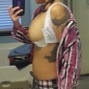 Day 1 Post Op  Side w/o bra 375/425cc HP