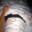 day of surgery
